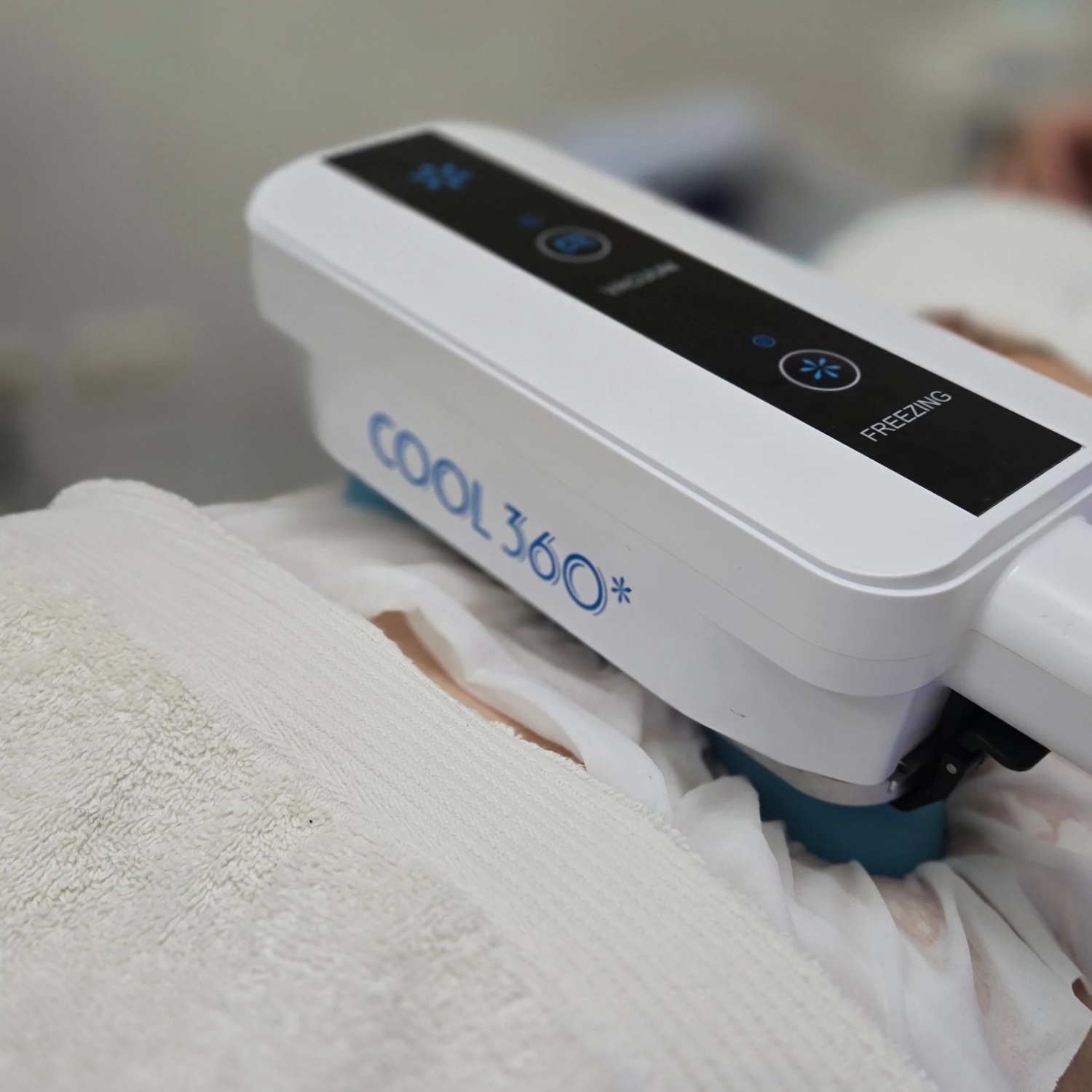 Aplikatorji Cool360 med obravnavo kriolipolize