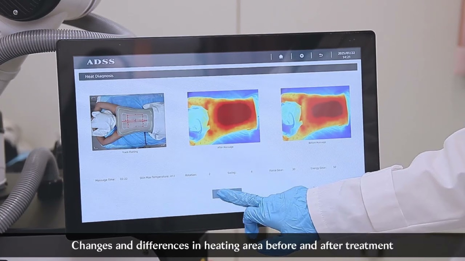 ADSS Heat Diagnosis — termalni prikaz pred in po obravnavi